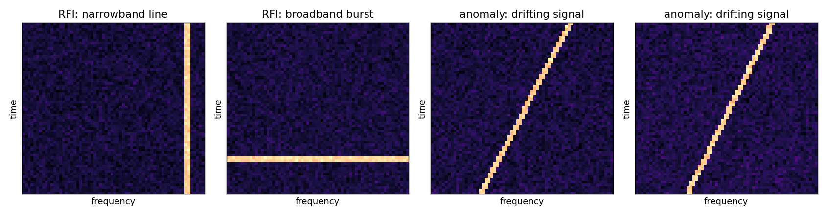 Example spectrogram tiles: a vertical RFI line, a horizontal burst, and two diagonal drifting-signal anomalies